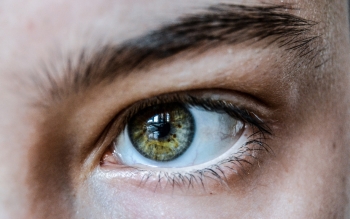 Glaucoma